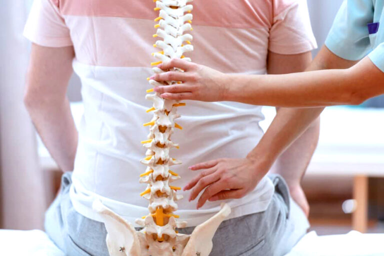 Terapia Bowen in tratamentul scoliozei