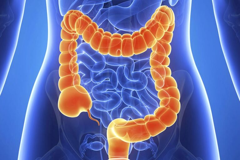 Terapia Bowen pentru sanatatea colonului